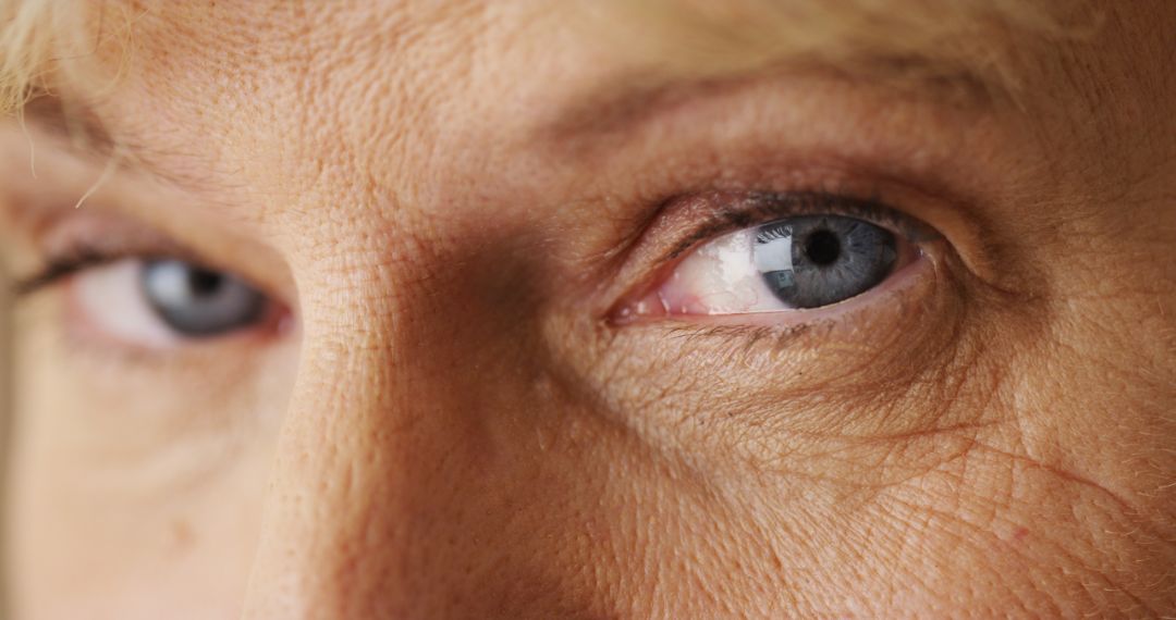 Retinose pigmentar, o que é e como se trata