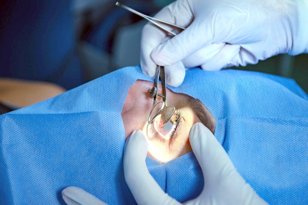 Entidades de oftalmologia enfatizam cumprimento das regras sanitárias para evitar complicações 