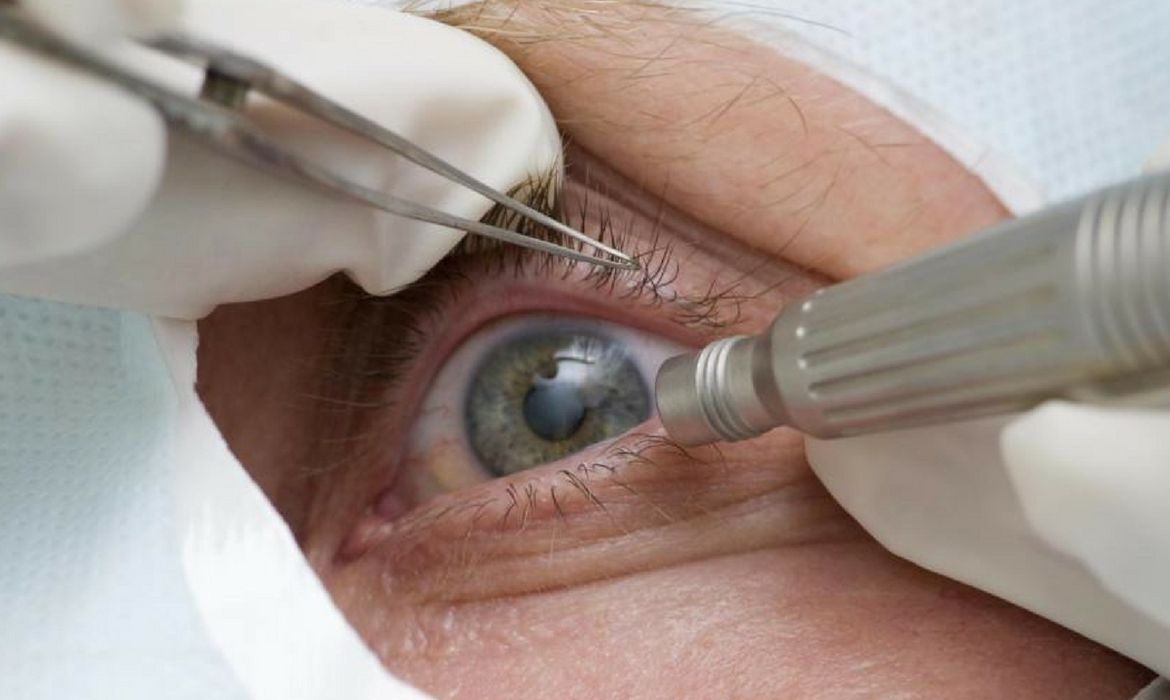 Saúde Entidades médicas cobram regras sanitárias em mutirões de cirurgias