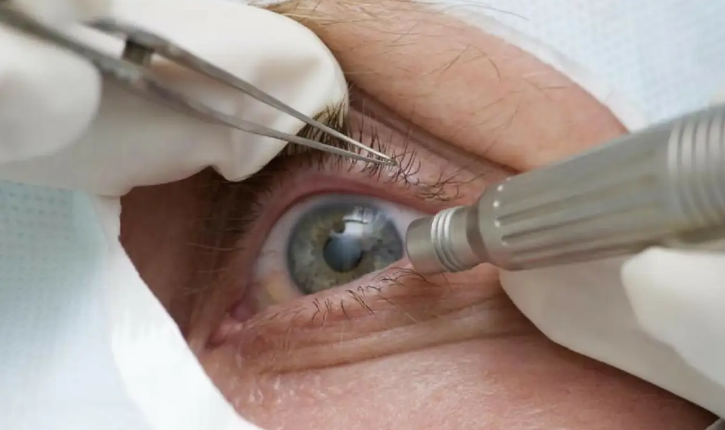 Alerta: CBO reforça que tatuagem na córnea só deve ser feita em pessoas cegas