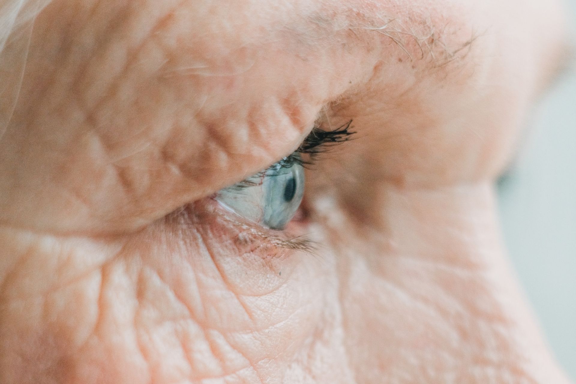 Degeneração Macular Relacionada à Idade